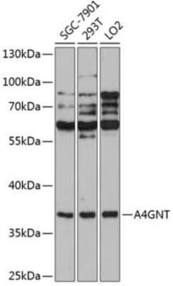 A4GNT Antibody - Azide and BSA Free, Novus Biologicals:Antibodies:Primary