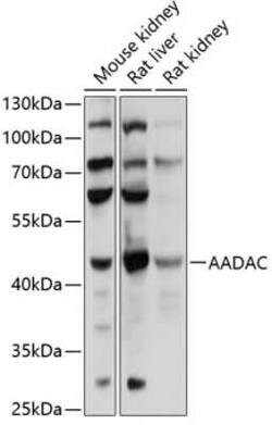 AADAC Antibody - BSA Free, Novus Biologicals 0.02 mL, Unconjugated:Antibodies,