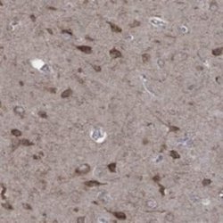 AADACL1 Rabbit anti-Human, Polyclonal, Novus Biologicals:Antibodies:Primary