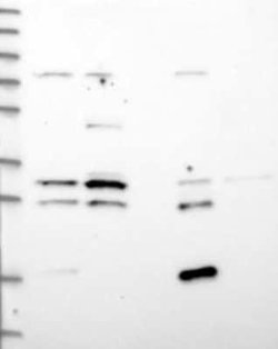 AADACL1 Rabbit anti-Human, Polyclonal, Novus Biologicals:Antibodies:Primary