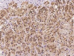 AAMDC Antibody, Novus Biologicals 50 &mu;g, Unconjugated:Antibodies, Polyclonal