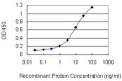 AAMP Antibody (2H2), Novus Biologicals 0.1 mg | Buy Online | Novus Biologicals | Fisher Scientific