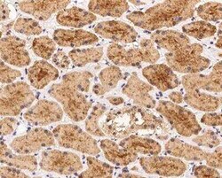 AAMP Antibody, Novus Biologicals 100 &mu;g; Unconjugated:Antibodies, Polyclonal