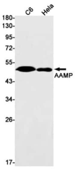 AAMP Antibody (S01-8F4), Novus Biologicals 50 &mu;g | Buy Online | Novus Biologicals | Fisher Scientific