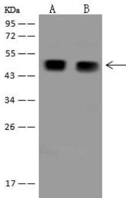 AAMP Antibody, Novus Biologicals 100 &mu;g; Unconjugated:Antibodies, Polyclonal