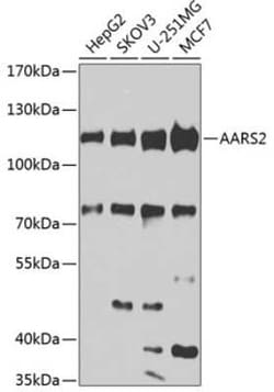 AARS2 Antibody - BSA Free, Novus Biologicals 0.1 mL, Unconjugated:Antibodies,