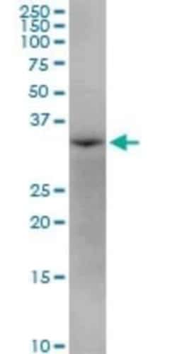 AASD-PPT Antibody, Novus Biologicals 0.05 mg | Buy Online | Novus Biologicals | Fisher Scientific