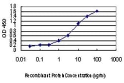 AATK/Serine/threonine-protein kinase LMTK1 Antibody (2D10), Novus Biologicals 0.1 mg | Buy Online | Novus Biologicals | Fisher Scientific