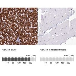 ABAT Antibody, Novus Biologicals:Antibodies:Primary Antibodies