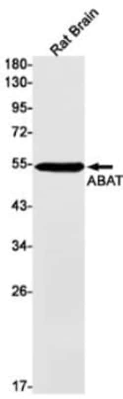 ABAT Antibody (S08-9E3), Novus Biologicals 100 &mu;g; Unconjugated:Antikörper
