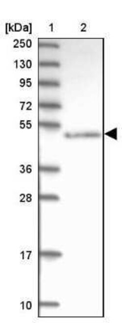 ABAT Antibody, Novus Biologicals:Antibodies:Primary Antibodies