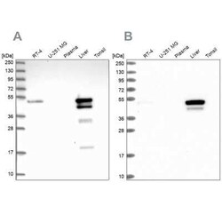 ABAT Antibody, Novus Biologicals:Antibodies:Primary Antibodies