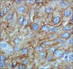 ABCA1 Antibody (HJ1) - Azide and BSA Free, Novus Biologicals 0.1 mL; Unconjugated:Antibodies,