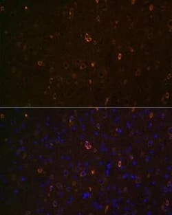ABCA2 Antibody - Azide and BSA Free, Novus Biologicals 0.02 mL, Unconjugated:Antibodies,