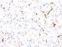 ABCB11 Antibody (IHC518), Novus Biologicals:Antibodies:Primary Antibodies