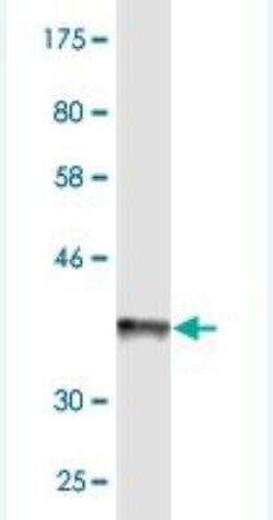 Novus Biologicals ABCB6 Antibody (3E1), Novus Biologicals 0.1 mg | Buy Online | Novus Biologicals&trade; | Fisher Scientific