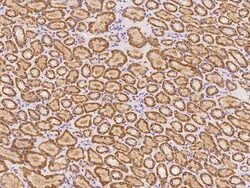 ABCB9 Antibody, Novus Biologicals 100 &mu;g | Buy Online | Novus Biologicals | Fisher Scientific
