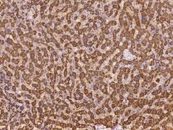 ABCB9 Antibody, Novus Biologicals 100 &mu;g | Buy Online | Novus Biologicals | Fisher Scientific