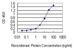 ABCC11 Antibody (4H6), Novus Biologicals 0.1 mg | Buy Online | Novus Biologicals | Fisher Scientific