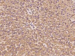 ABCC11 Antibody, Novus Biologicals 100 &mu;g | Buy Online | Novus Biologicals | Fisher Scientific