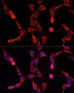 ABCD1 Antibody - Azide and BSA Free, Novus Biologicals 0.1 mL, Unconjugated:Anticorps,