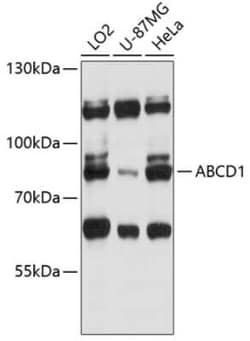 ABCD1 Antibody - Azide and BSA Free, Novus Biologicals 0.1 mL, Unconjugated:Anticorps,