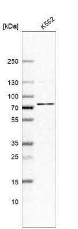 ABCF2 Antibody, Novus Biologicals:Antibodies:Primary Antibodies