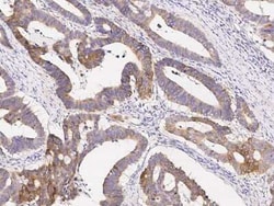 ABHD1 Antibody, Novus Biologicals:Antibodies:Primary Antibodies