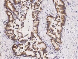 ABHD1 Antibody, Novus Biologicals:Antibodies:Primary Antibodies