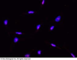 ABHD14B Rabbit anti-Human, Clone: 2, Novus Biologicals 50 &mu;g; Unconjugated:Antibodies,