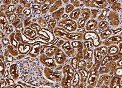 ABHD14B Antibody, Novus Biologicals:Antibodies:Primary Antibodies