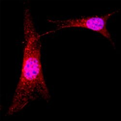 Human ABI1 Antibody, R D Systems 100 ug; Unconjugated:Antibodies, Monoclonal