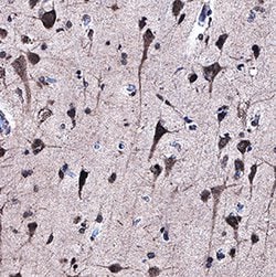 Human ABI1 Antibody, R D Systems 100 ug; Unconjugated:Antibodies, Monoclonal
