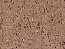 ABI2 Antibody, Novus Biologicals 100 &mu;g, Unconjugated:Antibodies, Polyclonal