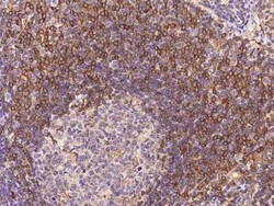 ABI3 Antibody, Novus Biologicals:Antibodies:Primary Antibodies