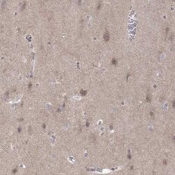 ABL2 Antibody, Novus Biologicals 25 &mu;L | Buy Online | Novus Biologicals | Fisher Scientific