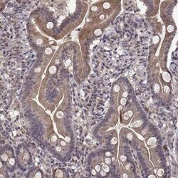ABL2 Antibody, Novus Biologicals 25 &mu;L | Buy Online | Novus Biologicals | Fisher Scientific
