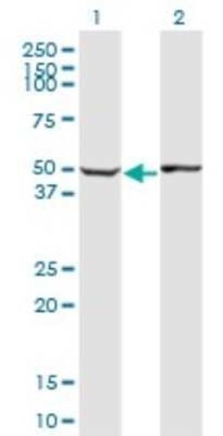 ABLIM1 Antibody (2C6), Novus Biologicals 0.1 mg, Unconjugated:Anticuerpos