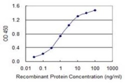 ABLIM1 Antibody (3A1), Novus Biologicals 0.1 mg | Buy Online | Novus Biologicals | Fisher Scientific