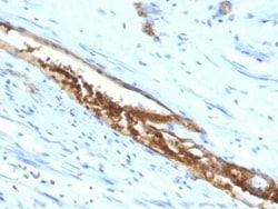 ABO, Blood Group A Antigen Antibody (3-3A), Novus Biologicals:Antibodies:Primary