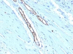 ABO, Blood Group A Antigen Antibody (HE-193), Novus Biologicals 0.1mg;