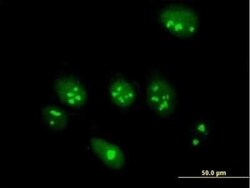 ABT1 Antibody, Novus Biologicals 0.05 mg | Buy Online | Novus Biologicals | Fisher Scientific
