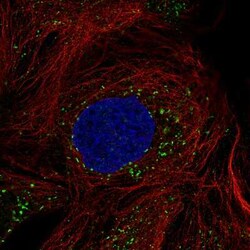 ACAA1 Antibody (CL2663), Novus Biologicals:Antibodies:Primary Antibodies