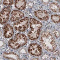 ACAA1 Antibody (CL2663), Novus Biologicals:Antibodies:Primary Antibodies