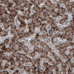 ACAA1 Antibody (CL2663), Novus Biologicals:Antibodies:Primary Antibodies