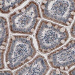 ACAA1 Antibody (CL2663), Novus Biologicals:Antibodies:Primary Antibodies