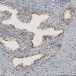 ACAA1 Antibody (CL2663), Novus Biologicals:Antibodies:Primary Antibodies