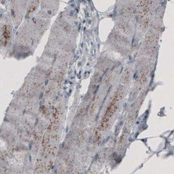 ACAA1 Antibody (CL2663), Novus Biologicals:Antibodies:Primary Antibodies