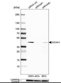 ACAA1 Antibody (CL2663), Novus Biologicals:Antibodies:Primary Antibodies