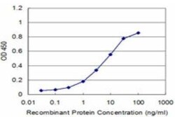 ACAA2 Antibody (2F7), Novus Biologicals 0.1 mg | Buy Online | Novus Biologicals | Fisher Scientific
